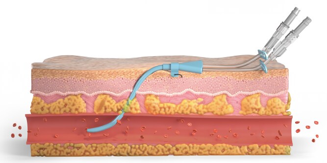 Cross section of skin
