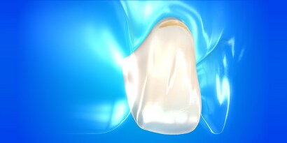 dental composite resin
