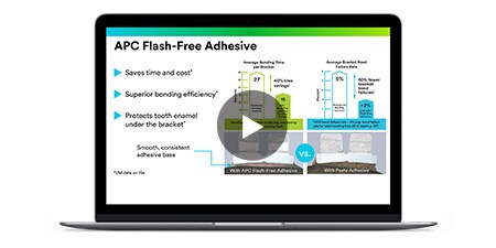 Direct Bonding Webinar laptop
