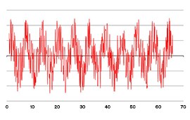 Acoustic Management