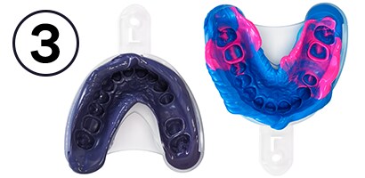 VPS and Polyether impressions
