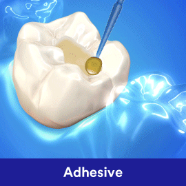 3m soflex dental polishing
