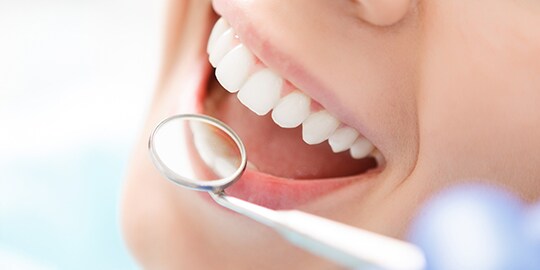 3m products for anterior restorations
