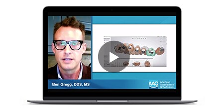 Efficiencies in direct bonding video laptop
