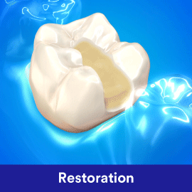 filtek one bulk fill composite for posterior restoration